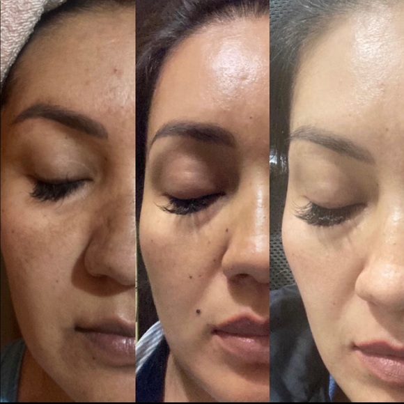 Roses water 🌹 tonic - Picture 4 of 6